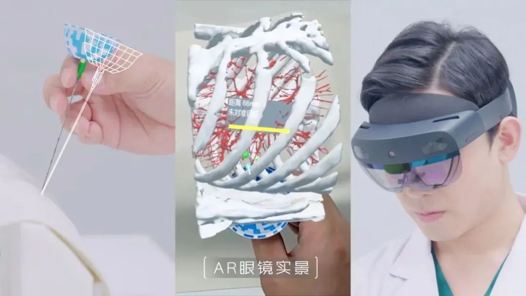 全球首创！复拓知达自研AI-AR导航设备获批，引领肺结节术中定位新时代  第2张